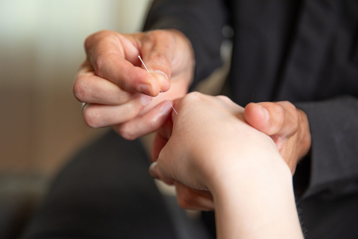 acupunctuur naaldje wordt in hand geprikt